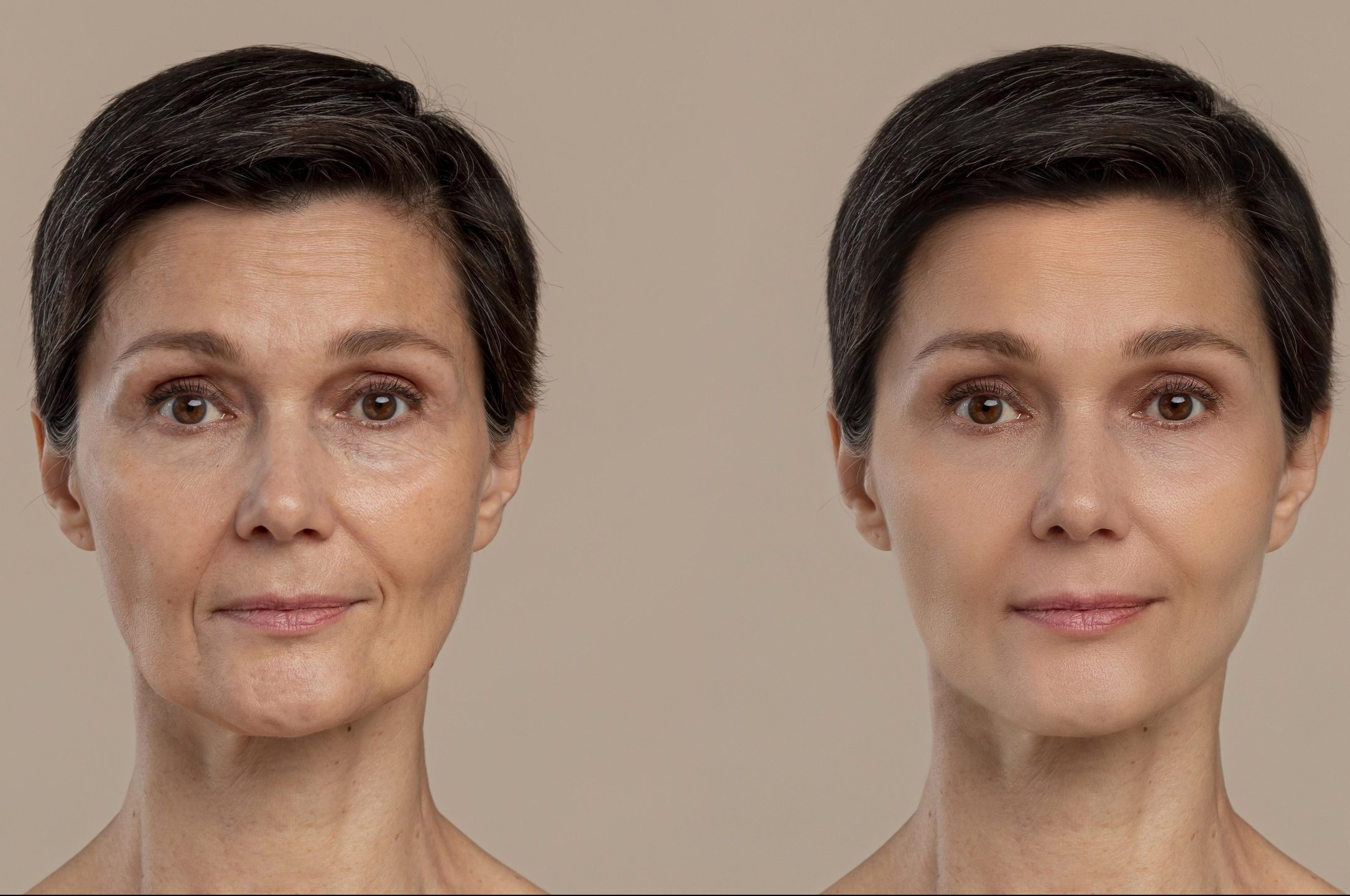 antiaging-beauty-treatment