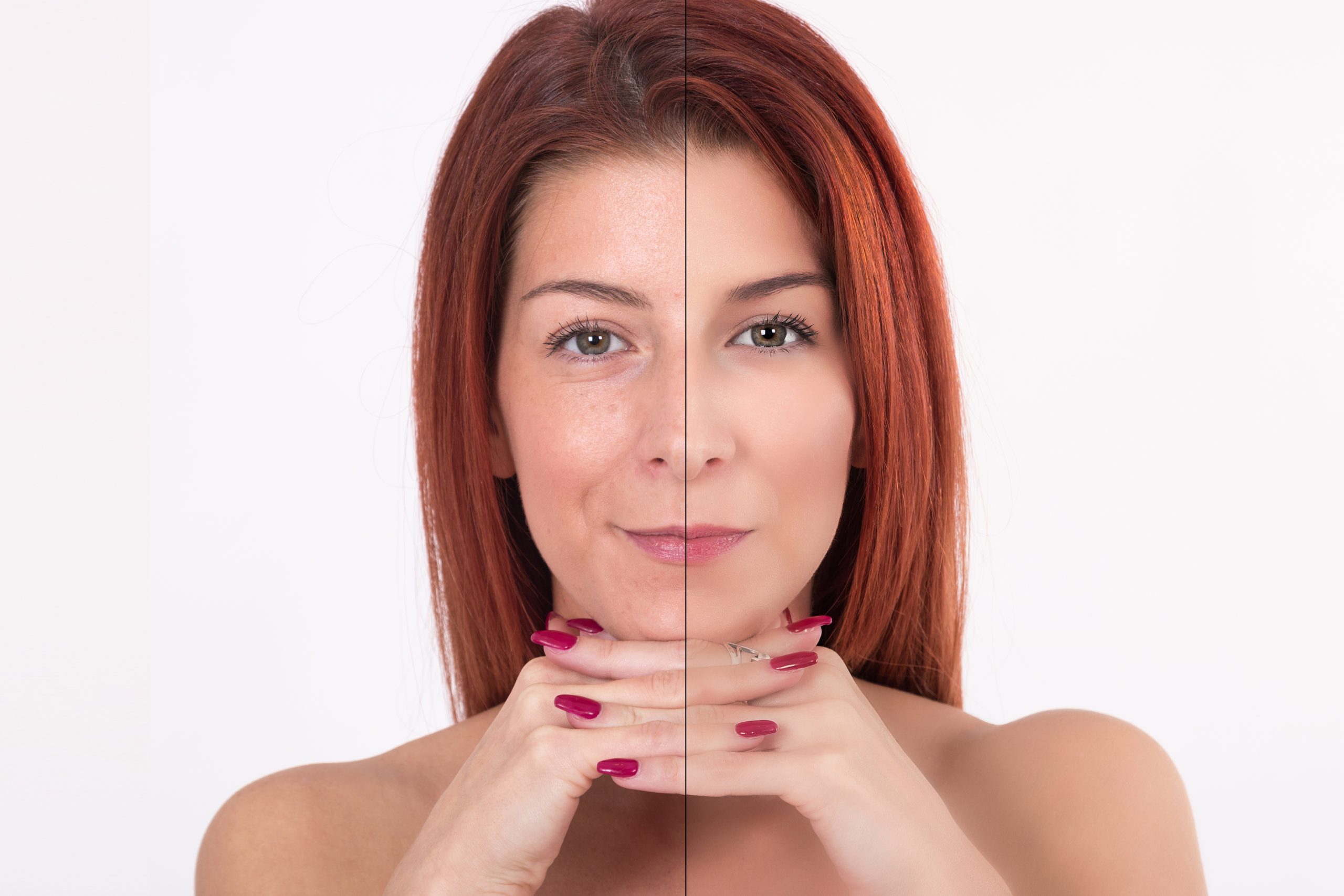 Comparison before and after cosmetic procedure. Portrait of beauty woman after plastic surgery.